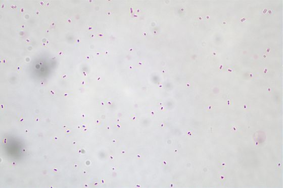 Akkermansia Muciniphila AKK016 AKK Από λευκό έως ανοιχτό γκρι σκόνη/ Προβιοτικά
